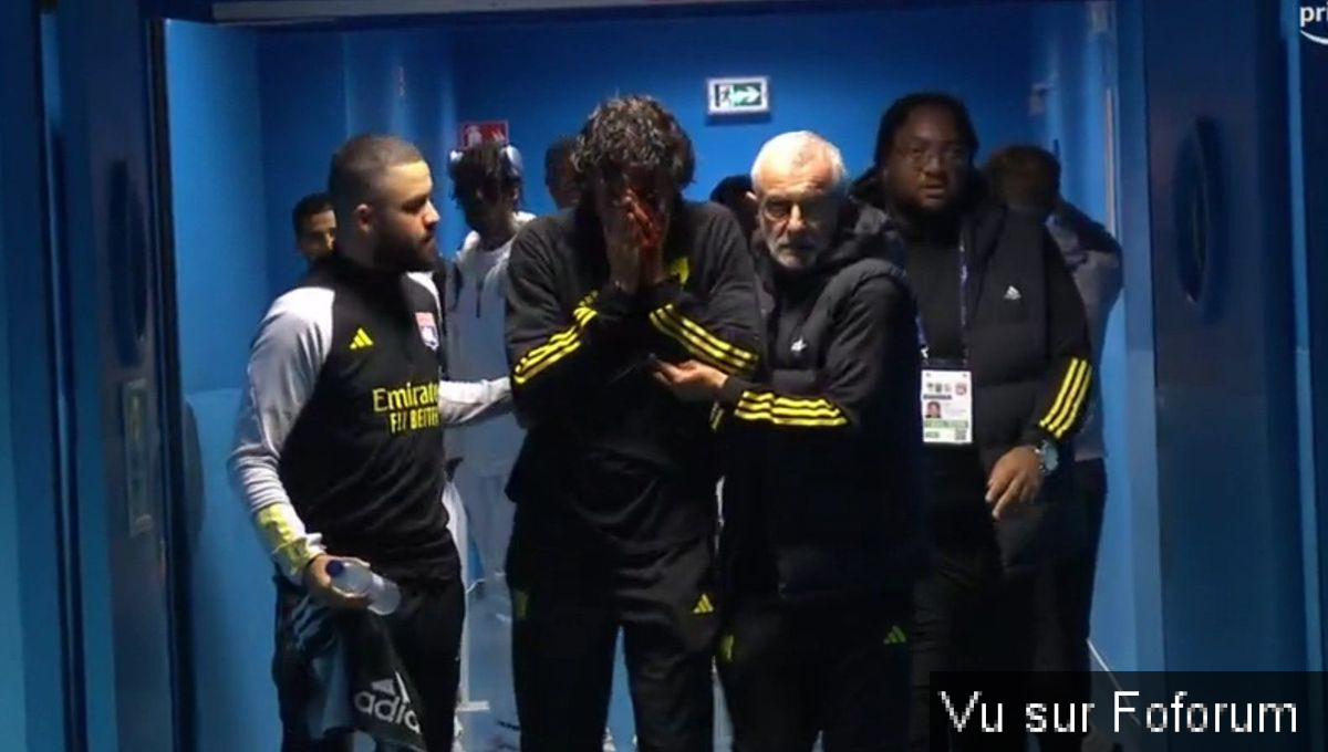 Tragédie à Marseille : Le Match Marseille-Lyon Reporté Après le Caillassage du Bus de l'OL et la Blessure de Fabio Grosso